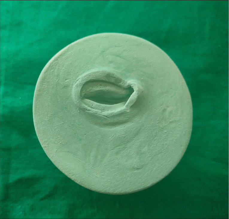 Mold for acrylization.