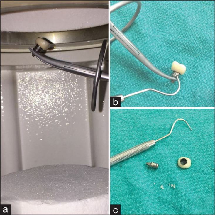 (a) Prostheses in a ceramic furnace. (b) Detaching crown with explorer. (c) Cement removal.