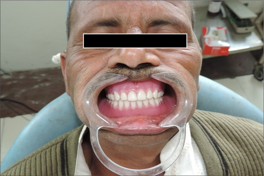 Post-operative photograph.